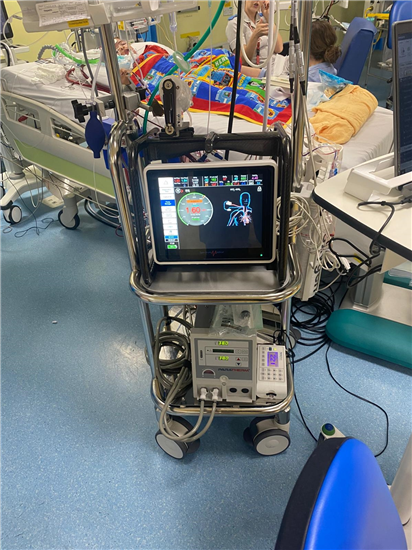 The new state of the art ECMO machine that supported Freddie