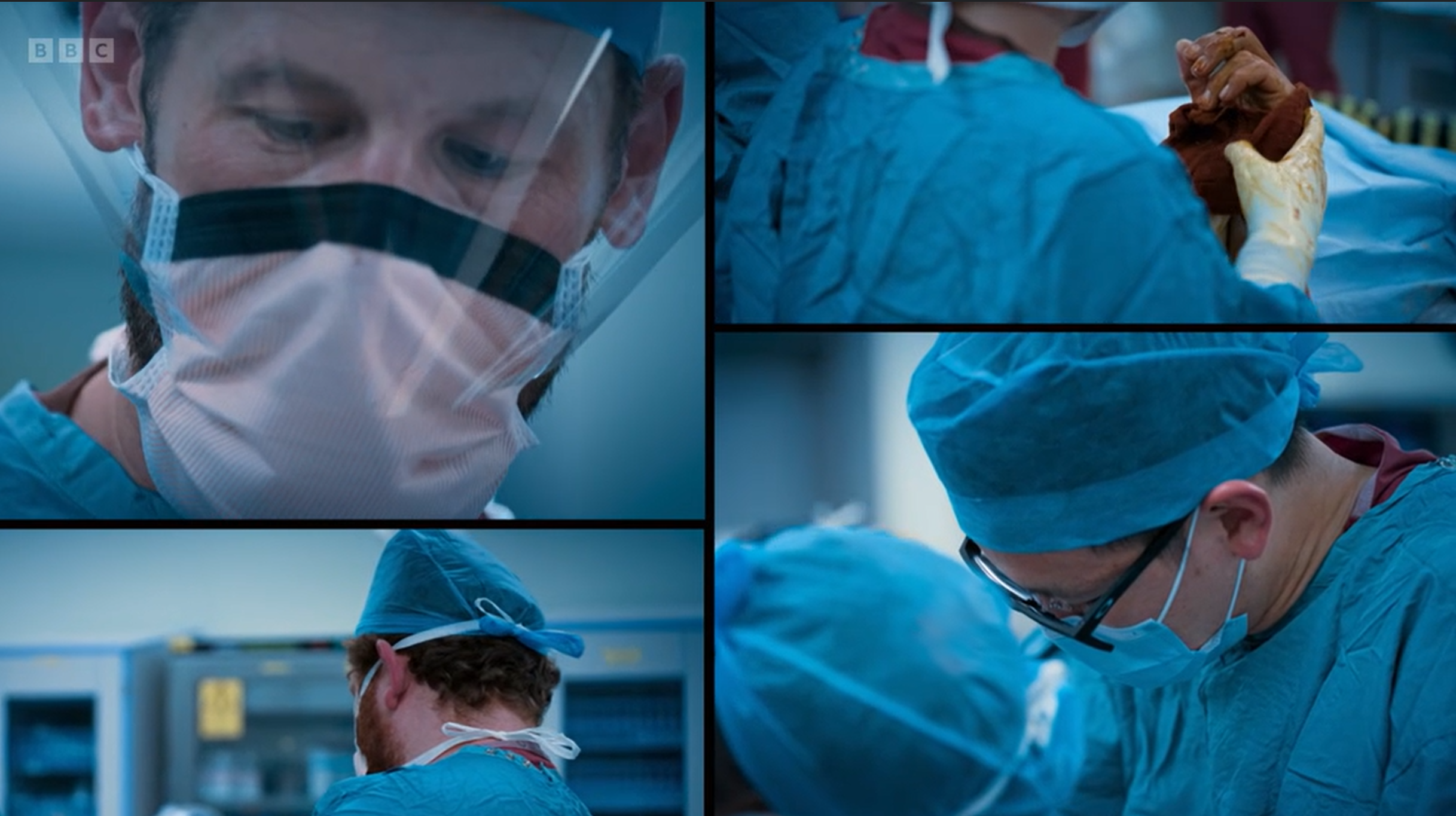 A collage of four operating theatre scenes showing healthcare staff wearing surgical gowns, masks, caps and protective visors. Close-up views show members of the surgical team concentrating during a procedure, with one panel showing gloved hands working on a patient's arm. The operating theatre is lit with cool blue tones, and medical equipment can be seen in the background.